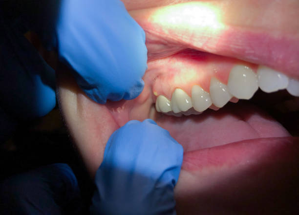 Best Emergency Denture Repair in Mathews, VA