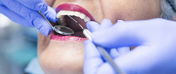 Best Emergency Tooth Extraction in Mathews, VA